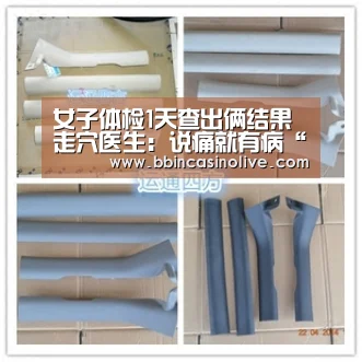 女子体检1天查出俩结果走穴医生:说痛就有病“BBIN真人,BBIN入口,BBIN捕鱼,BBIN棋牌”(图1) BBIN真人,BBIN入口,BBIN捕鱼,BBIN棋牌